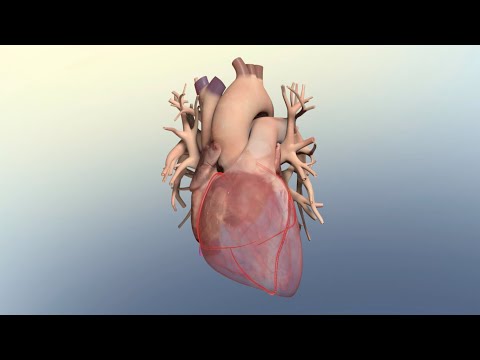 Видео: Как ишемическая болезнь сердца может привести к сердечному приступу
