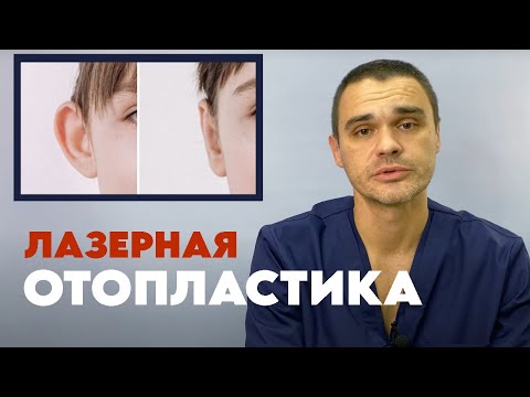 Видео: Лазерная отопластика | Коррекция лопоухости #пластическийхирург #доктор