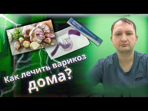 Видео: Как лечить варикоз дома