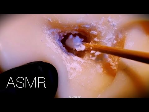 Видео: ASMR Расслабляющая чистка ушей, которая создаст ощущение, будто вы идете по снегу  (No talking)
