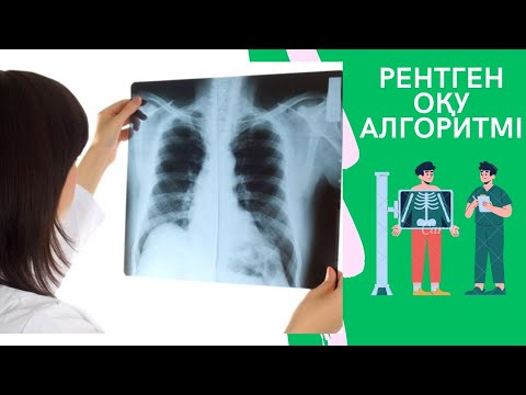 Видео: Рентген оқу алгоритмі | Как читать рентген снимок