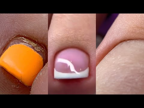 Видео: Педикюр Френч подробно😍Френч на ногах💅Дизайн ногтей