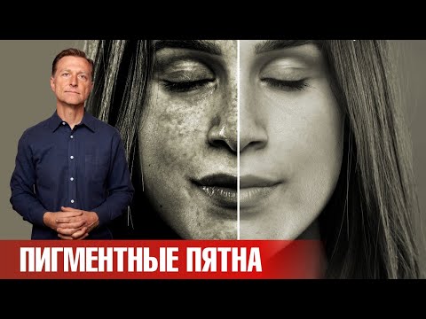 Видео: Как убрать пигментные пятна от солнца? Лучшее средство👍