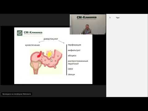 Видео: Запись вебинара «Дивертикулез толстой кишки» - Пересада И.В. (08.05.2018)