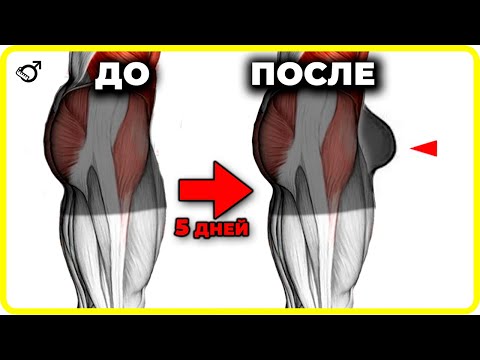 Видео: 5 лучших упражнений Кегеля