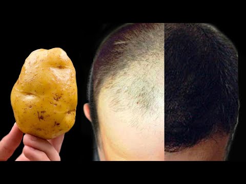 Видео: Волосы растут как сумасшедшие и не выпадают! Сильнейшее средство от выпадения волос !