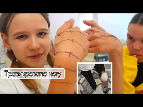 Видео: Мама привет! У меня нога сложилась пополам!