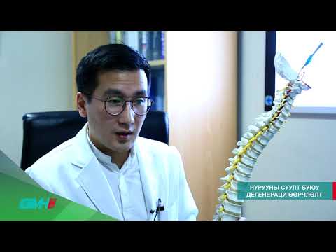 Видео: Нурууны суулт Грандмед эмнэлэг