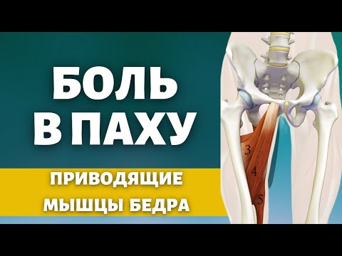 Видео: Боль в паху. Приводящие мышцы бедра