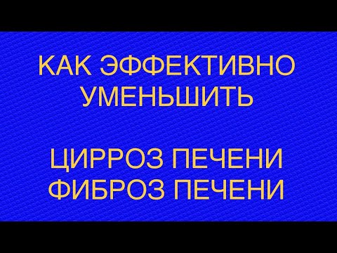 Видео: Фиброз печени, цирроз печени. Современные методики лечения| доктор Вожаков