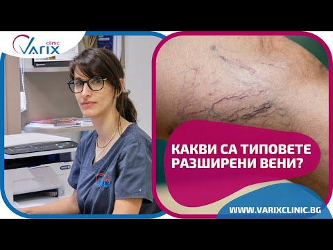 Видео: Какви са типовете разширени вени?