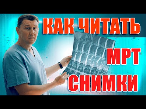 Видео: МРТ позвоночника - как читать снимки?|Нейрохирург Александр Печиборщ