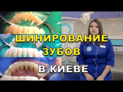 Видео: Шинирование зубов у стоматолога в Киеве (видео) - Люми-Дент (шинування зубів)