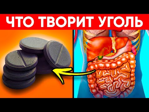 Видео: ВОТ ЧТО ТВОРИТ АКТИВИРОВАННЫЙ УГОЛЬ! (Реальная Польза и Вред Активированного Угля)