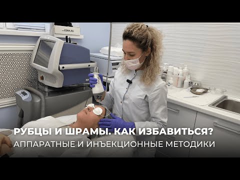 Видео: РУБЦЫ И ШРАМЫ. КАК ИЗБАВИТЬСЯ?