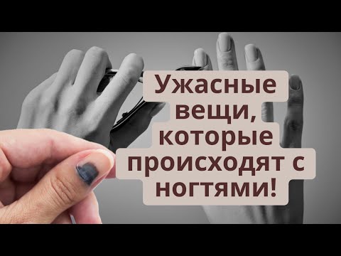 Видео: Ужасные вещи, которые происходят с ногтями!