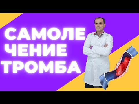 Видео: Это лекарство помогло избавиться от тромба. Флеболог Москва.