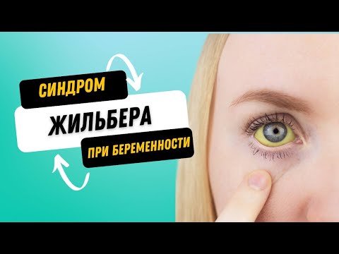 Видео: СИНДРОМ ЖИЛЬБЕРА И БЕРЕМЕННОСТЬ @DrOlenaB