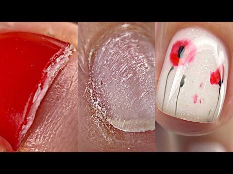 Видео: Так делать нельзя!!!😬Маникюр при диабете💅Преображение ногтей😍Дизайн ногтей маки