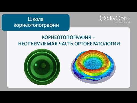 Видео: Школа корнеотопографии:  Корнеотопография - неотъемлемая часть ортокератологии