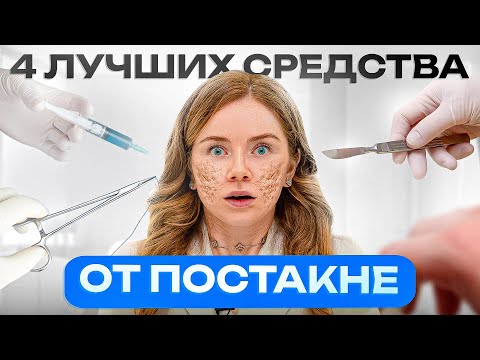 Видео: Как избавиться от постакне? Пошаговый рецепт от пятен и рубцов