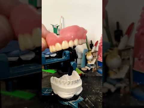 Видео: HARZLABS Dental Crown LT В полном съёмном протезе