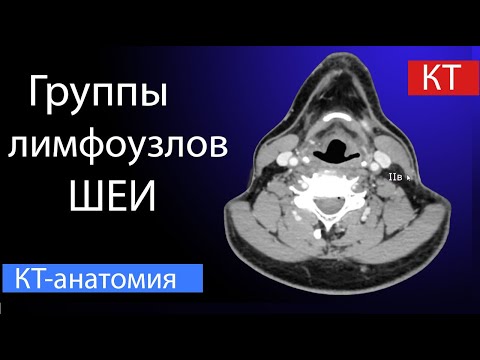 Видео: Уровни лимфоузлов шеи на КТ:  разбор для рентгенолога