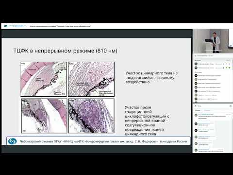 Видео: Школа поликлинического врача Глаукома в практике врача офтальмолога 28 09 2023