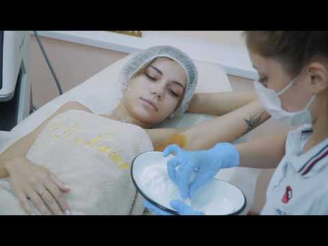 Видео: Лечение гипергидроза RF-иглами