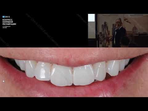 Видео: Stefano Conti   B O P T  Ограничения и преимущества  Розовая эстетика  Вертикальное и горизонтальное