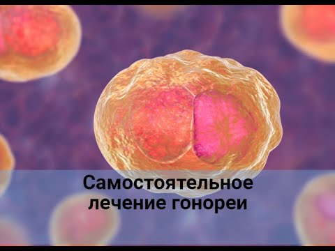 Видео: Гонорея. Лечение самостоятельно.