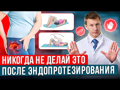 Видео: ЭТИ УПРАЖНЕНИЯ СЛЕДУЕТ ИЗБЕГАТЬ после эндопротезирования тазобедренного сустава