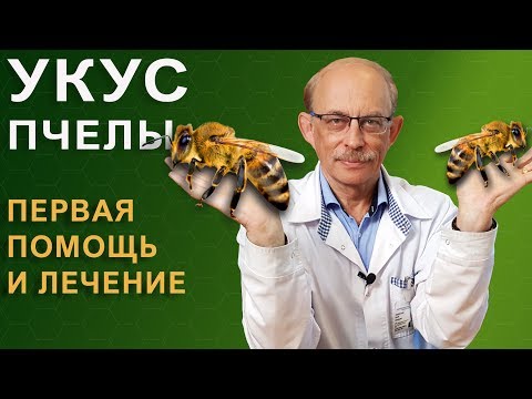 Видео: Укус пчелы - что делать, как снять опухоль, опасные симптомы, аллергия