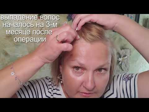 Видео: Шунтирование желудка - ОТЗЫВ. Питание,порции и витамины.
