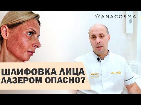 Видео: 🔥Лазерная шлифовка лица 🔥ОПАСНО?🔥 Восстановление, ДО и После