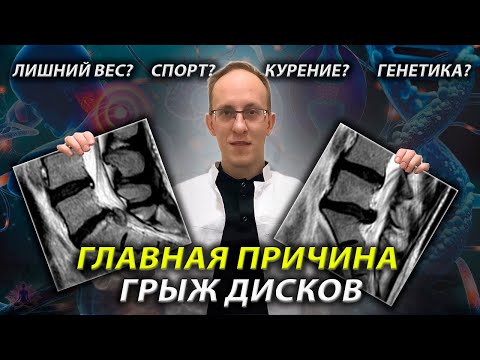 Видео: Из-за чего возникают грыжи в позвоночнике? Как их предотвратить?