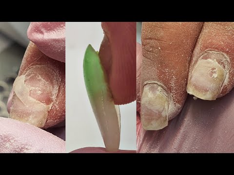 Видео: НА СОПЛЯХ ПРОСТО 🤧😢