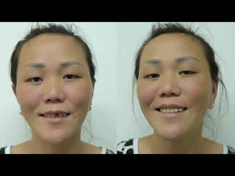 Видео: 78 КЕЙІПКЕР | АЙНУР | 26 ЖАСТАҒЫ АНА