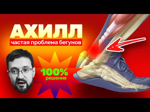 Видео: Остерегайся этих симптомов. Самая опасная беговая травма. Ахилл. Советы Демченко.
