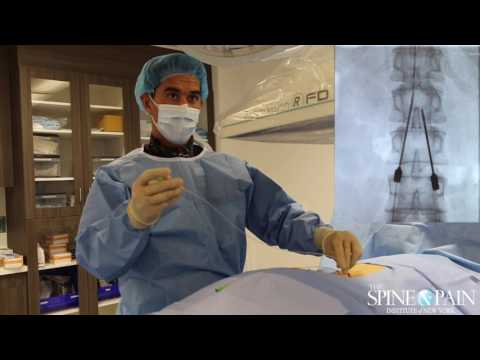 Видео: Испытание стимулятора спинного мозга