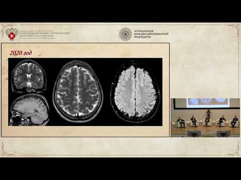 Видео: ЭПИЛЕПСИЯ 2023, дело 4: Этюд в багровых тонах