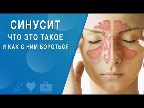 Видео: Синусит. Что это такое и как с ним бороться. На здоровье 08.05.2021