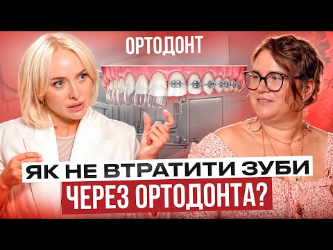 Видео: Брекети чи елайнери: що обрати у 2024? Як чистять зуби стоматологи? Зуби мудрості та еволюція щелепи