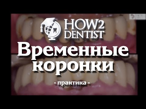 Видео: Как изготовить временные коронки. Часть 3 - Практика / How to Dentist