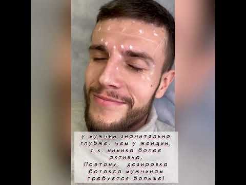 Видео: Ботокс для мужчин. Иньекции ботокса.