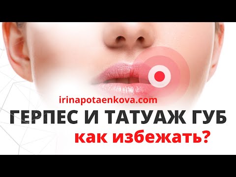 Видео: Герпес после татуажа губ. Что делать и как предотвратить?