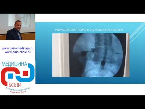 Видео: Навигация и визуализация при проведении внутрикостной терапии. Артамонов М.Ю.