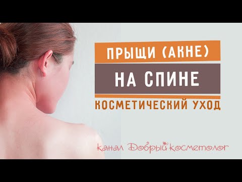 Видео: Прыщи на спине - проф.уход для проблемной кожи тела с акне