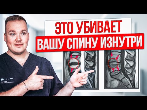 Видео: Как вылечить ХРОНИЧЕСКУЮ БОЛЬ в спине. Почему  лечение МОДИК не работает