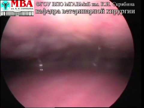 Видео: гнойный плеврит1